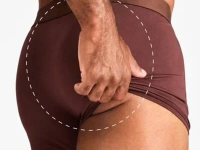 Fesses